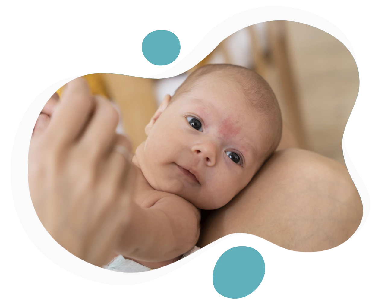Bebeklerde Kontakt Dermatit Nedenleri ve Tedavisi